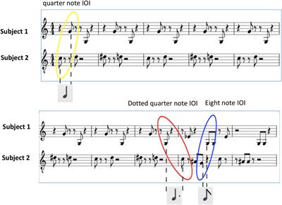 Timing Markers of Interaction Quality During Semi-Hocket Singing